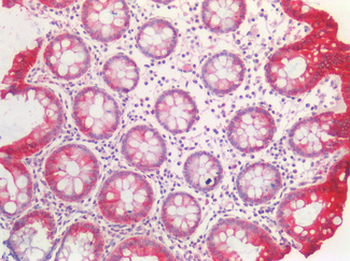 KRT20/CK20/Cytokeratin 20 Antibody