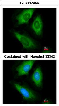 HPRT1/HPRT Antibody