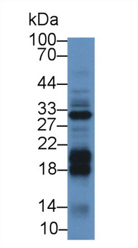 DGKA Antibody