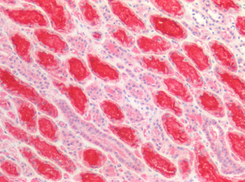 LRP2/Megalin Antibody