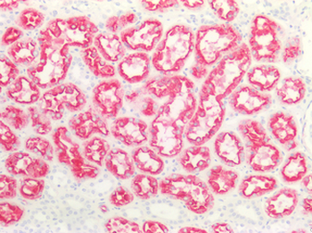 Renal Cell Carcinoma Antibody