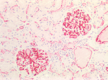 PECAM-1/CD31 Antibody