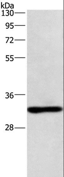 NAPSA/NAPA/Napsin A Antibody