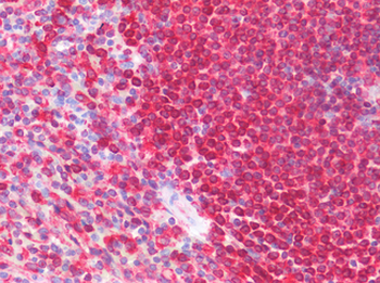 CD74/CLIP Antibody