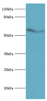 ACVR2/ACVR2A Antibody