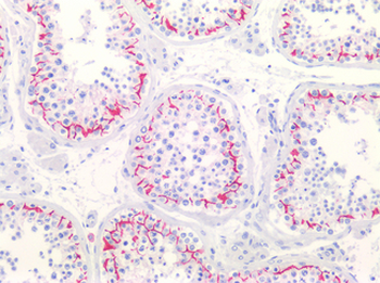 CLDN11/Claudin 11 Antibody