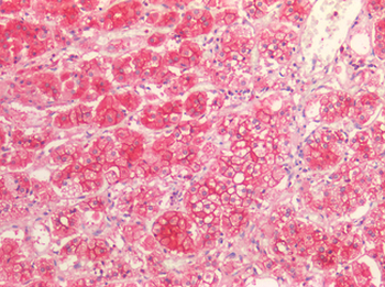 SCARB1/SR-BI Antibody