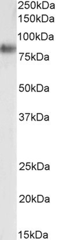 SCARB1/SR-BI Antibody