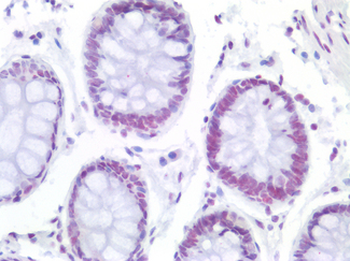 NFE2/p45 Antibody