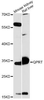 QPRT Antibody