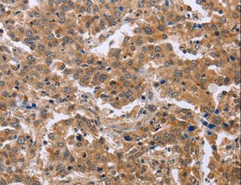 EPDR/EPDR1 Antibody