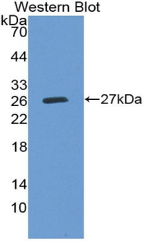 Prekallikrein Antibody