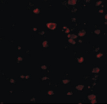 KIAA1811/BRSK1 Antibody