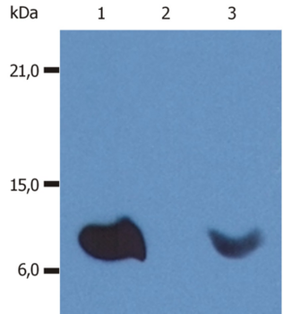 B2M/Beta 2 Microglobulin Antibody