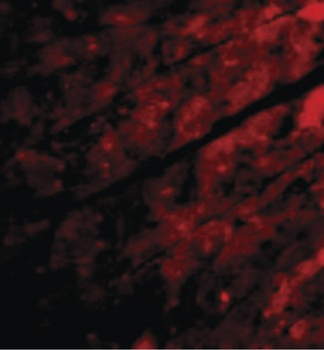 TRPC3 Antibody