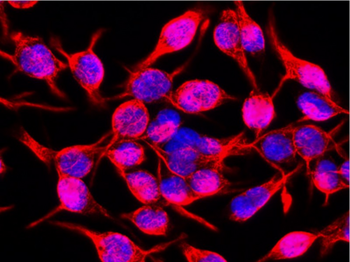Vimentin Antibody