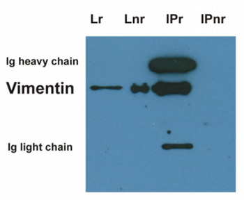 Vimentin Antibody