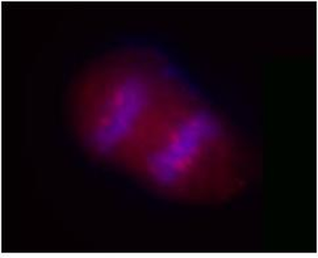 SIK2/SNF1LK2 Antibody