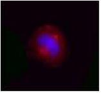 VCP Antibody