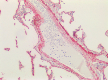 CAV1/Caveolin 1 Antibody