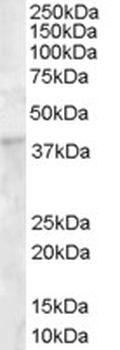DKK1 Antibody