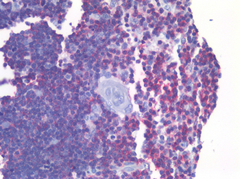 LAT Antibody