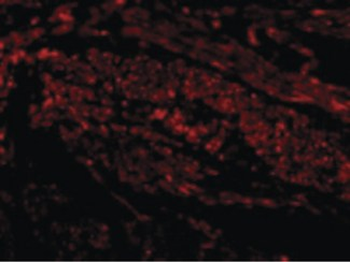 HAVCR1/KIM-1 Antibody