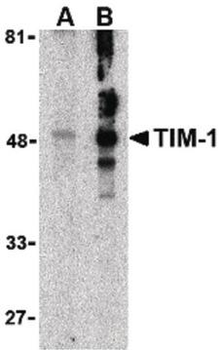HAVCR1/KIM-1 Antibody