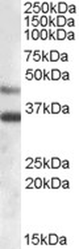 ARSB/Arylsulfatase B Antibody