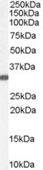 VDAC2 Antibody