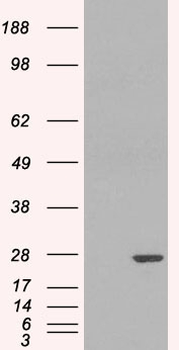 GSTP1/GST Pi Antibody