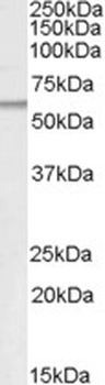 PNPLA2/ATGL Antibody