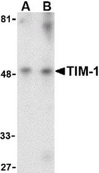 HAVCR1/KIM-1 Antibody