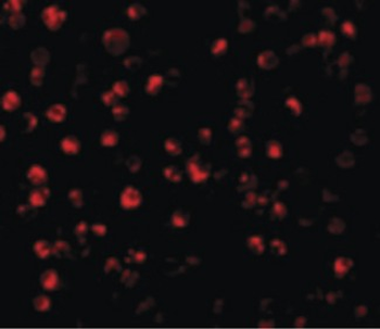 ATF6 Antibody