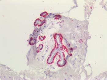 TAGLN/Transgelin/SM22 Antibody
