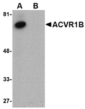 ACVR1B/ALK4 Antibody