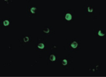NOD2/CARD15 Antibody