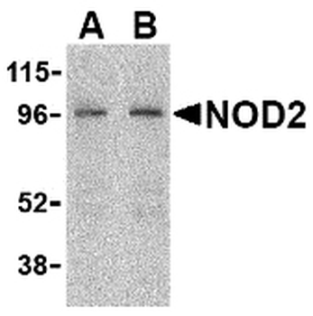 NOD2/CARD15 Antibody