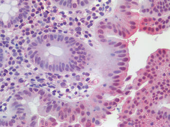 ATG16L1/ATG16L Antibody
