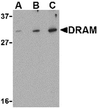 DRAM1/DRAM Antibody