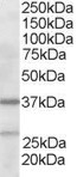 ARPC1B/p41-ARC/ARP2 Antibody