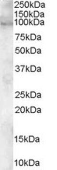 ADAM12 Antibody