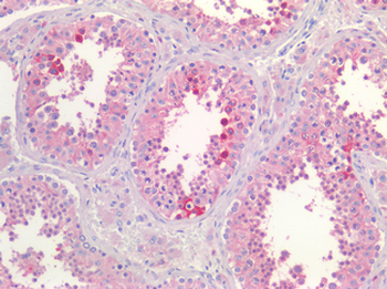 CLU/Clusterin Antibody
