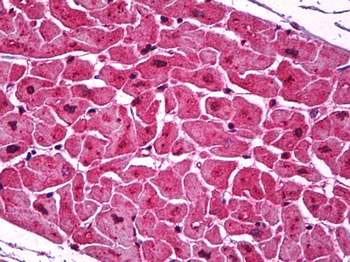 PDPN/Podoplanin Antibody