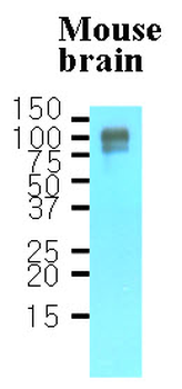 APP/Beta Amyloid Precursor Antibody