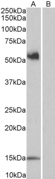 CD14 Antibody