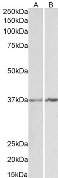 ANXA1/Annexin A1 Antibody
