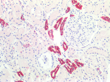 KRT19/CK19/Cytokeratin 19 Antibody