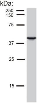 KRT19/CK19/Cytokeratin 19 Antibody