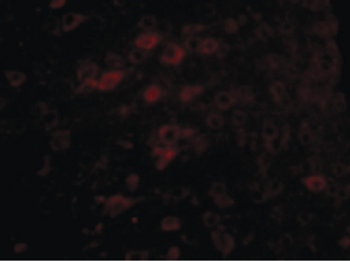 CerS6/LASS6 Antibody